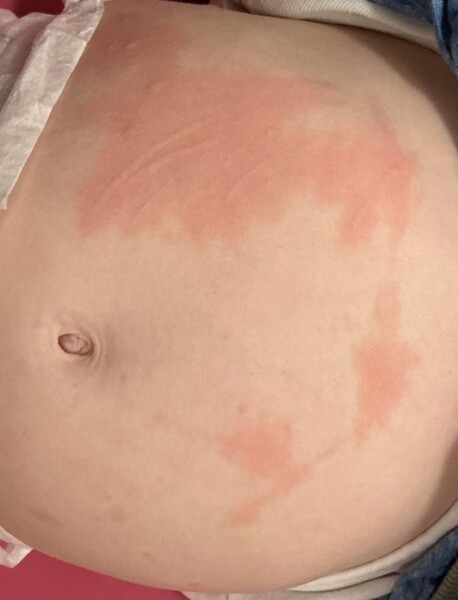 Any chance this is chicken pox