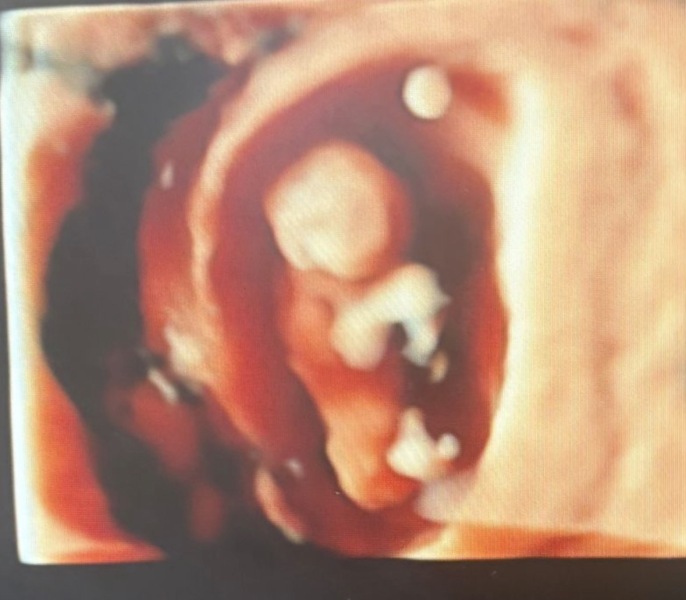 Boy or girl?