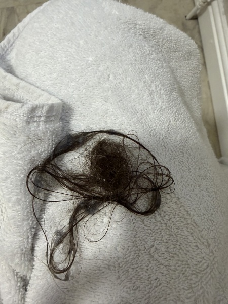 Postpartum hair loss after birth: what is normal and when to worry?