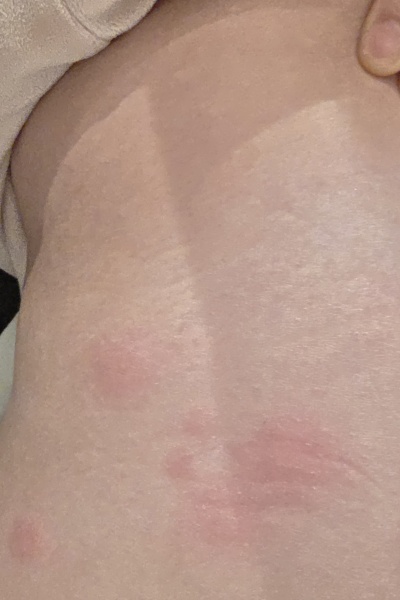 What the heck keeps biting me at night? 😳