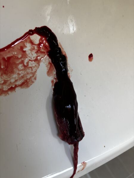 How to get a dr to take me seriously includes graphic pictures