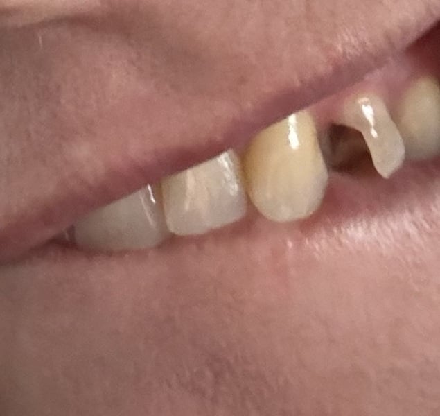 Can any dentists help me?