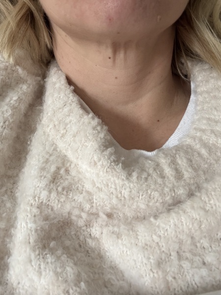 April 2025 Mounjaro Starters - Thread 6!