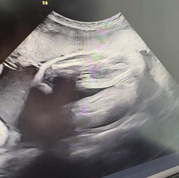 Partner wants surprise but I want to know baby's gender at 30 weeks- can someone confirm from potty shot?