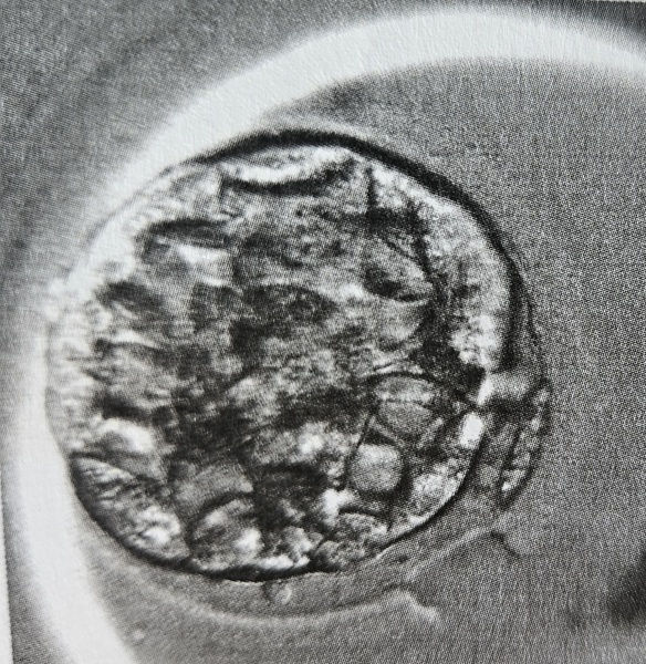 IVF march 2026