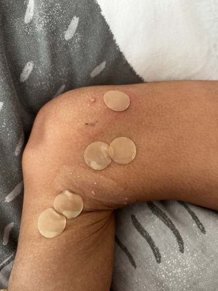 Molluscs taking over my life