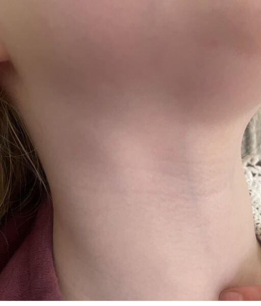 Can anyone see their child's lymph nodes in neck?