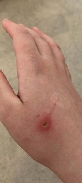 Does this cat scratch look infected