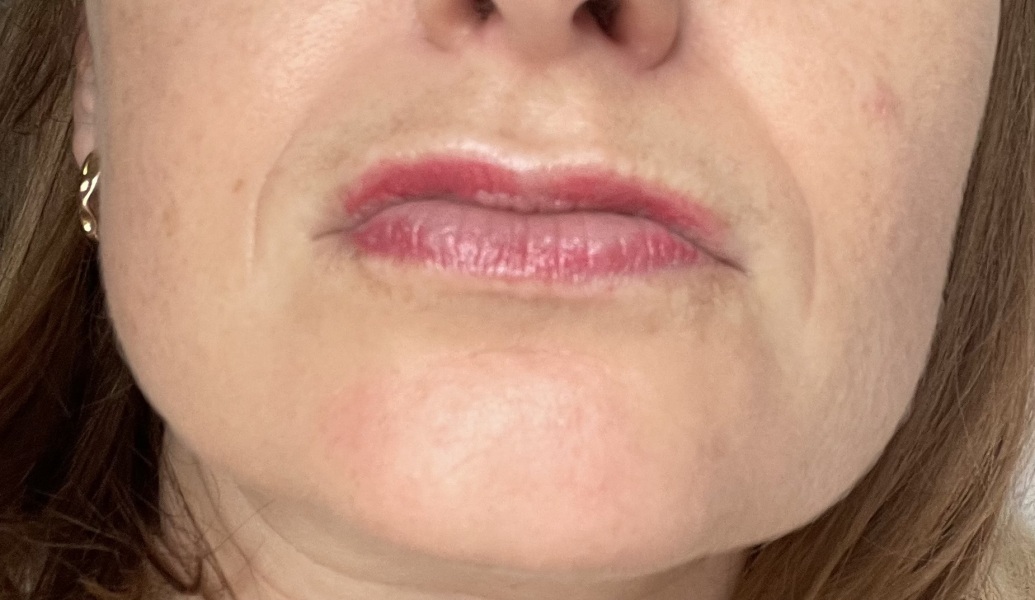 Lip blush looks patchy after 10 days, will it even out?
