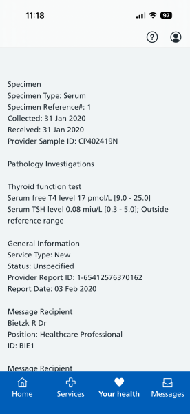 WTF? Hyperthyroidism!
