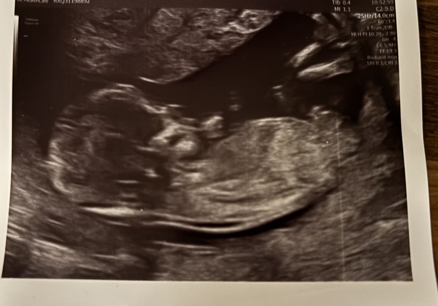 Can a 13 week 5 day scan show baby's sex reliably?