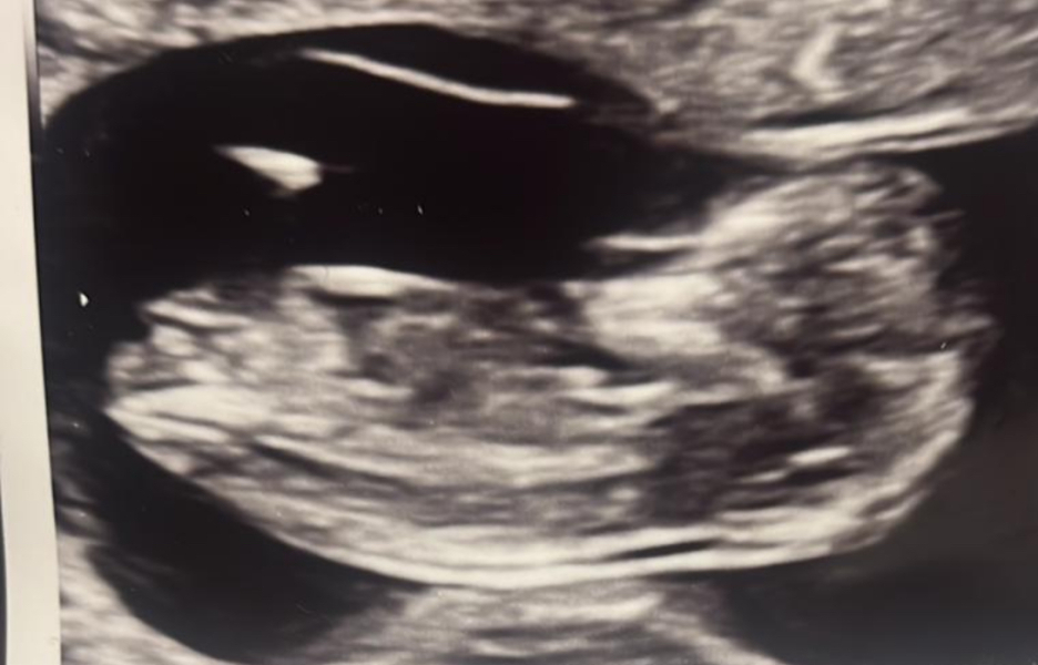 Girl or boy any guesses??