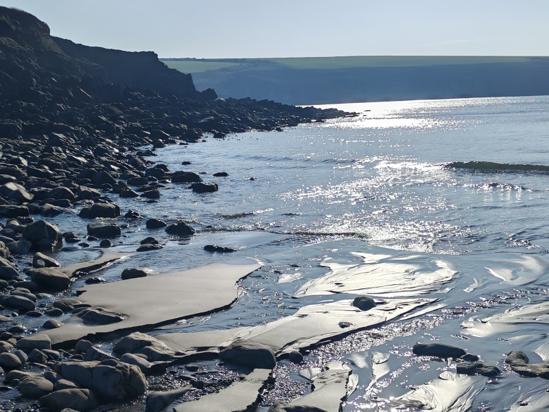 Retroperitoneal Leiomyosarcoma part 2