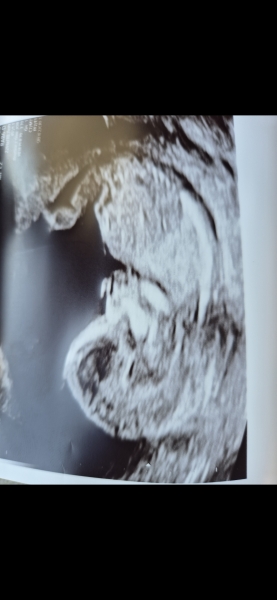 Nub Theory Guesses? 13w