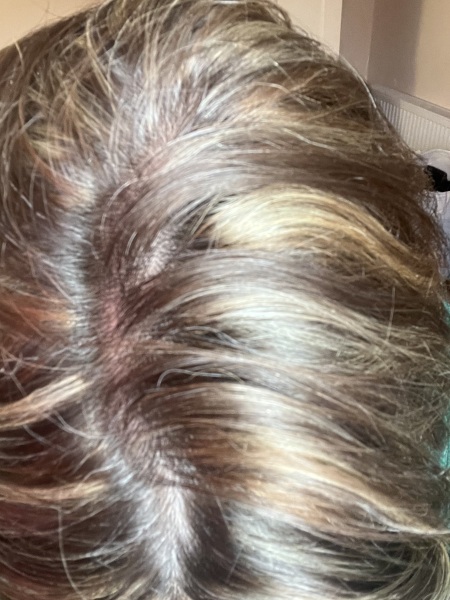 Highlights streaky AIBU and how to fix