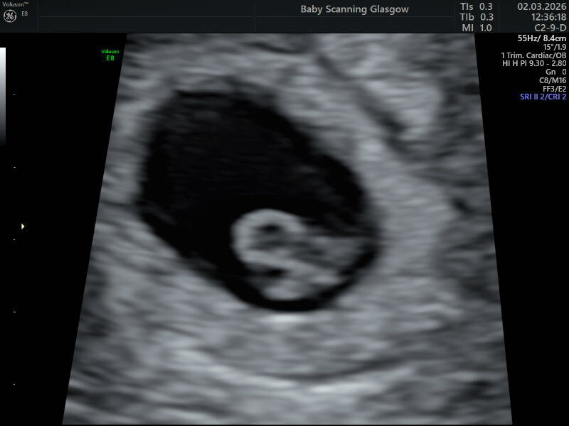 18DPO line progression