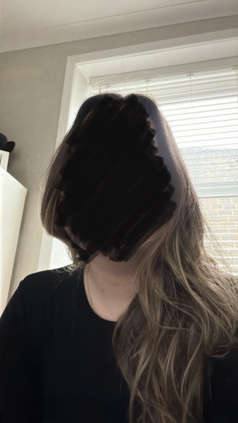 Postpartum hair loss after birth: what is normal and when to worry?