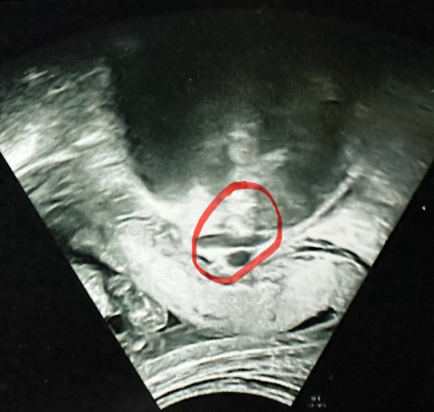 Potty shot... is this a boy or girl? See 5 photos!