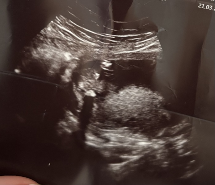 Potty shot 16+1 weeks