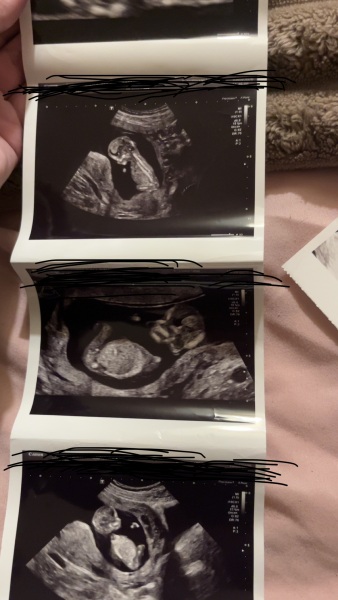 Any fun guesses on baby’s sex from my 12 week scan?