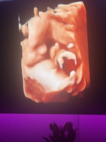 Boy or girl?