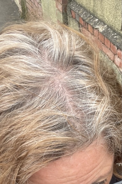 Going grey - how to do no more dye? Temp ? Toning?