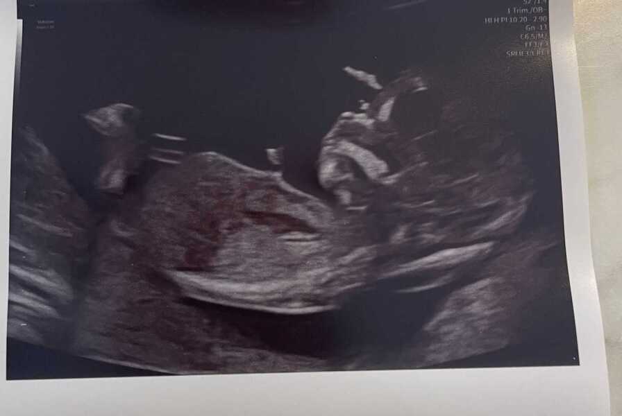 Nub theory