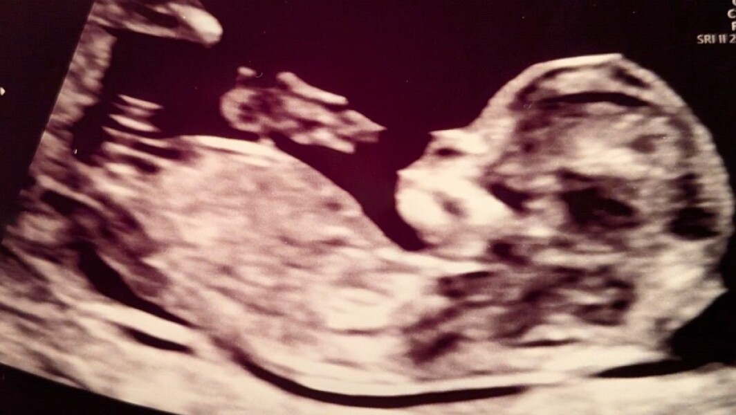 Gender predictions please!