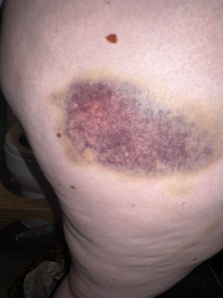 On a mission to moderate or absolutely abstain (judgement-free zone). New thread - Autumn 2025.