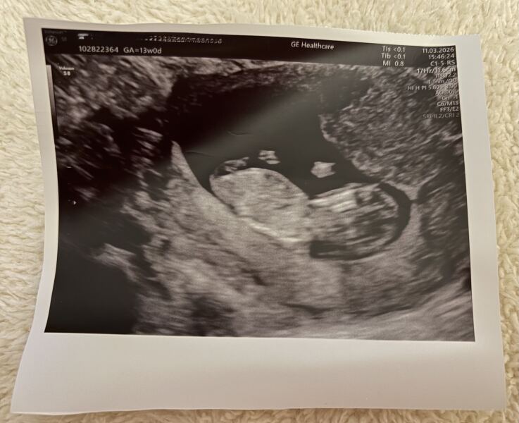 Due September 2026 🐣💖🙏🤞