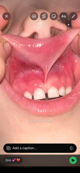 Someone help me diagnose my child gum 💔
