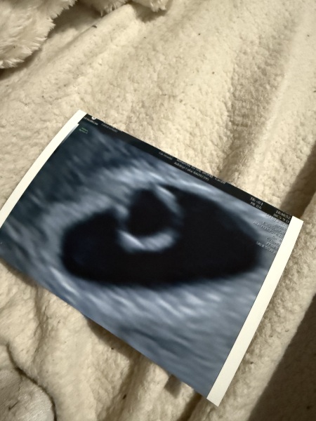 6 week scan measuring 5+3, embryo seen but no heartbeat yet