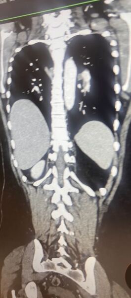 Anybody know how to interpret CT contrast images?