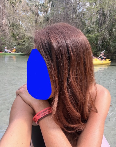 Why is my hair snapping so badly?