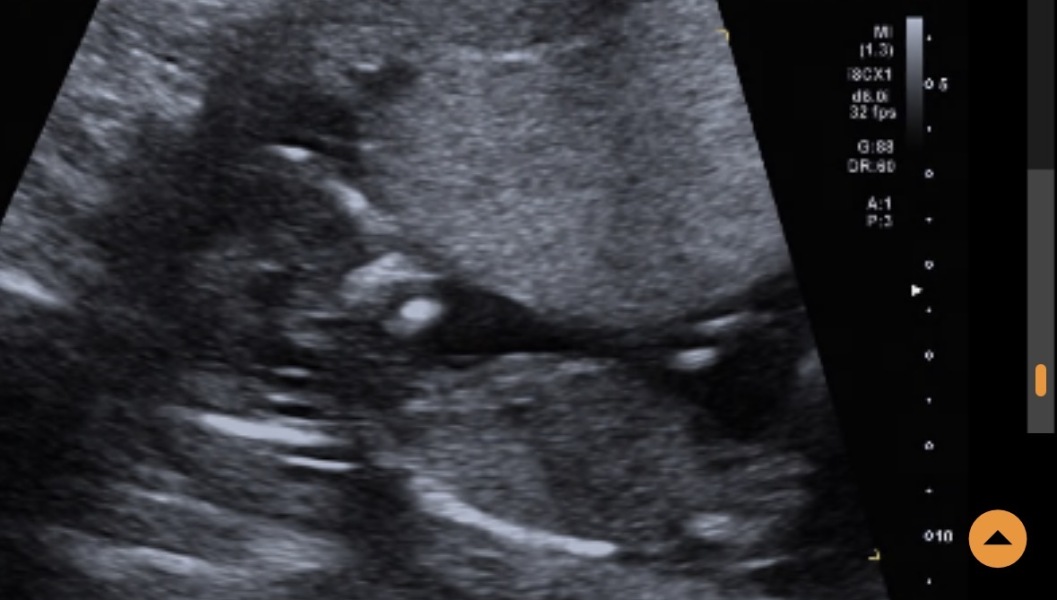 Boy or girl based on skull
