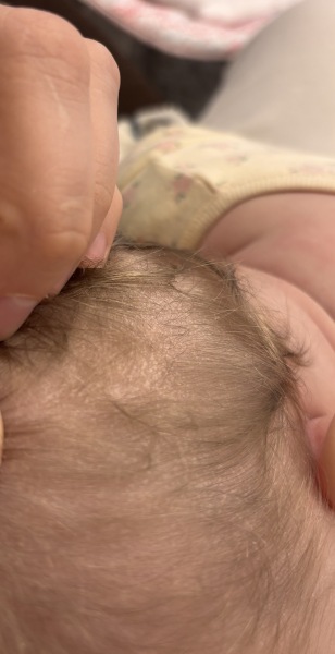 Baby has extremely dry scalp , what to use ?