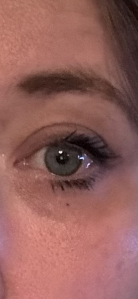 Under eye circles, getting me down!