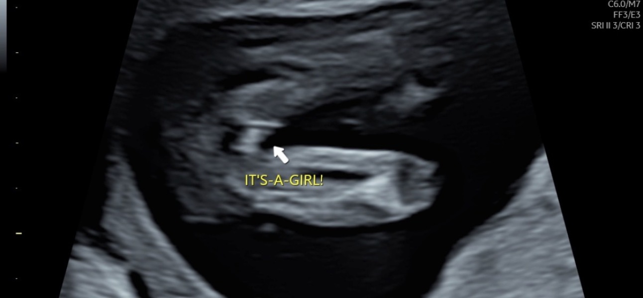 Potty Shot Boy or Girl?