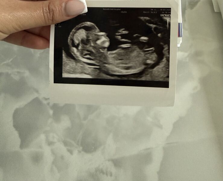 Gender Guesses
