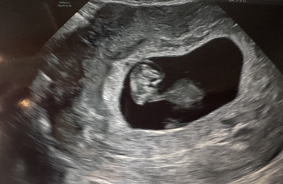🎇 Due November 26 🎆