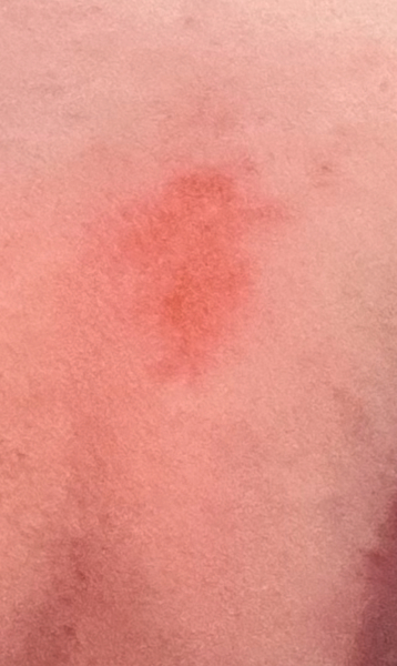 Advice for cover up/skin care for razor burn