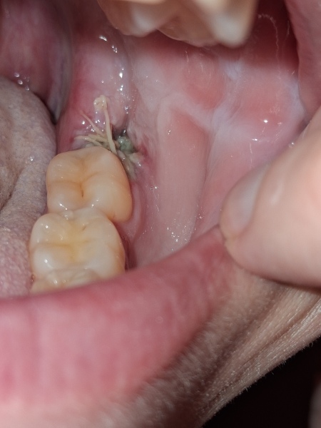 ANY DENTISTS ABOUT?