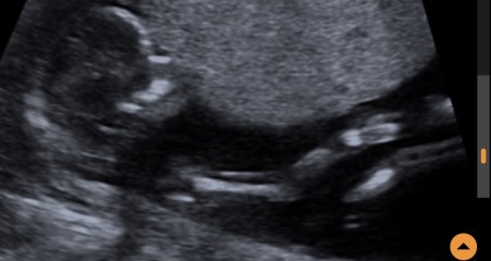 Boy or girl based on skull