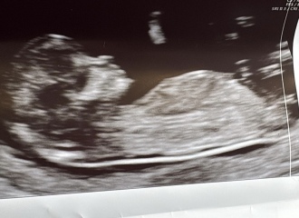 Name suggestions for fifth baby, gender unknown, after four boys