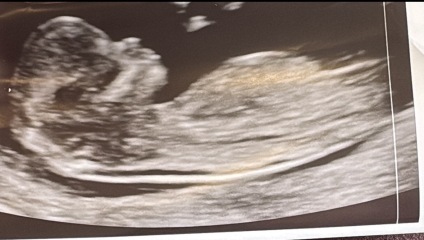 Name suggestions for fifth baby, gender unknown, after four boys