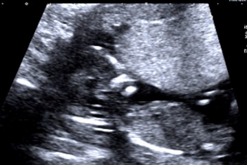 Boy or girl based on skull
