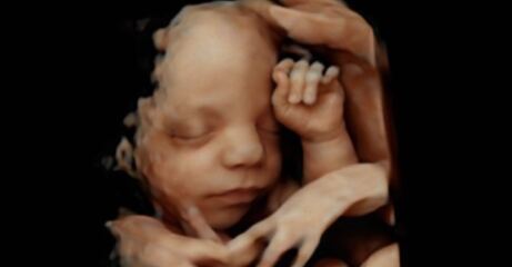 IVF Pregnancy Club- Part Two