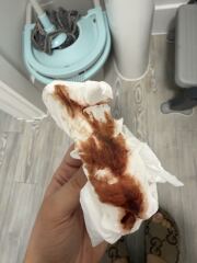 Bleeding while 4 weeks pregnant