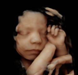 IVF Pregnancy Club- Part Two