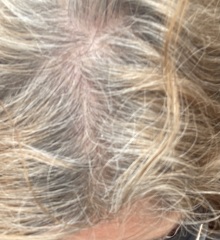 Going grey - how to do no more dye? Temp ? Toning?